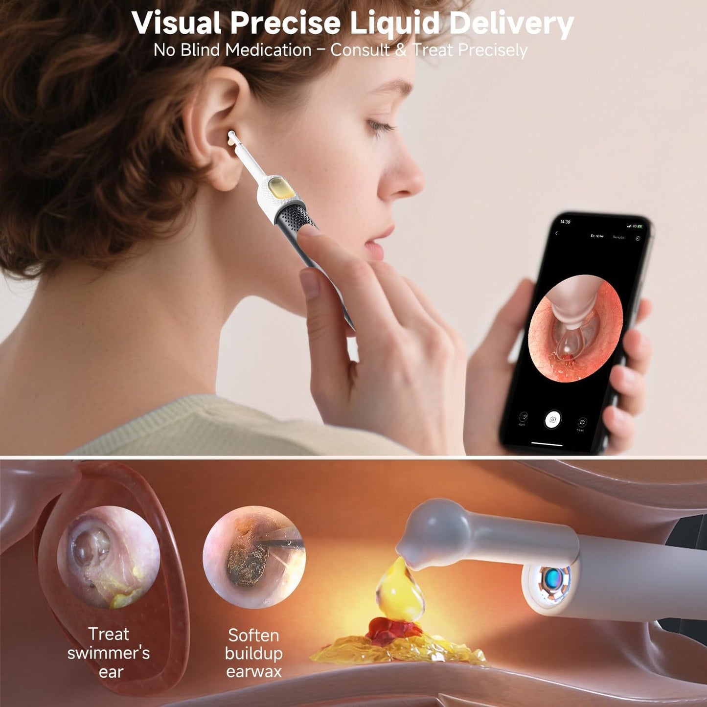 Rechargeable Wireless Ear Camera Kit – Smart Ear Cleaner